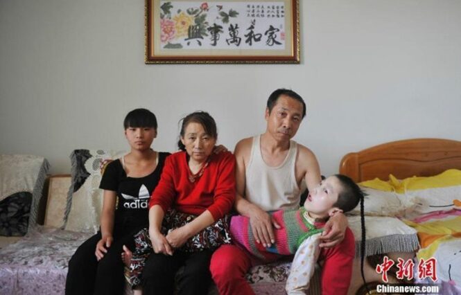 Casal leva bebê com paralisia para casa e há 15 anos alimenta criança boca a boca após mastigar a comida