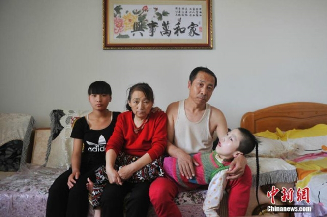 Casal leva bebê com paralisia para casa e há 15 anos alimenta criança boca a boca após mastigar a comida