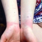 Mãe se revolta depois de policiais algemarem e ferirem sua filha autista com capacidade mental de uma criança de 5 anos