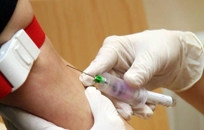 Nova vacina contra vírus HIV será testada na África do Sul