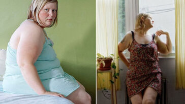 Obesa passa 11 anos fotografando seu corpo para tentar amar a si mesma mas desiste e acaba passando por cirurgia de redução de estômago
