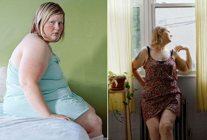 Obesa passa 11 anos fotografando seu corpo para tentar amar a si mesma mas desiste e acaba passando por cirurgia de redução de estômago
